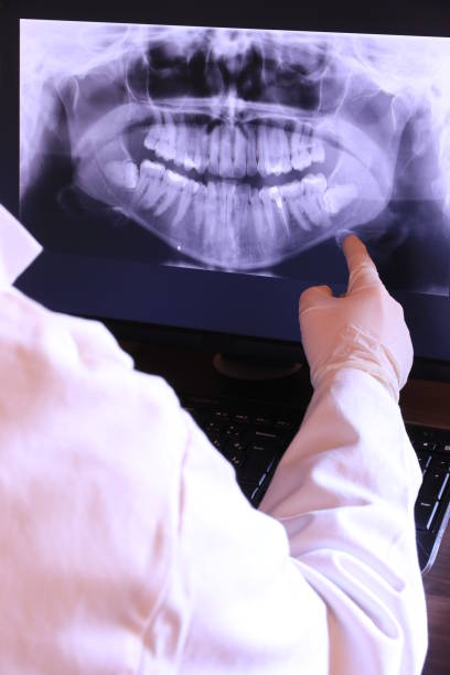 Best Emergency Treatment for Oral Infections in Universal City, TX